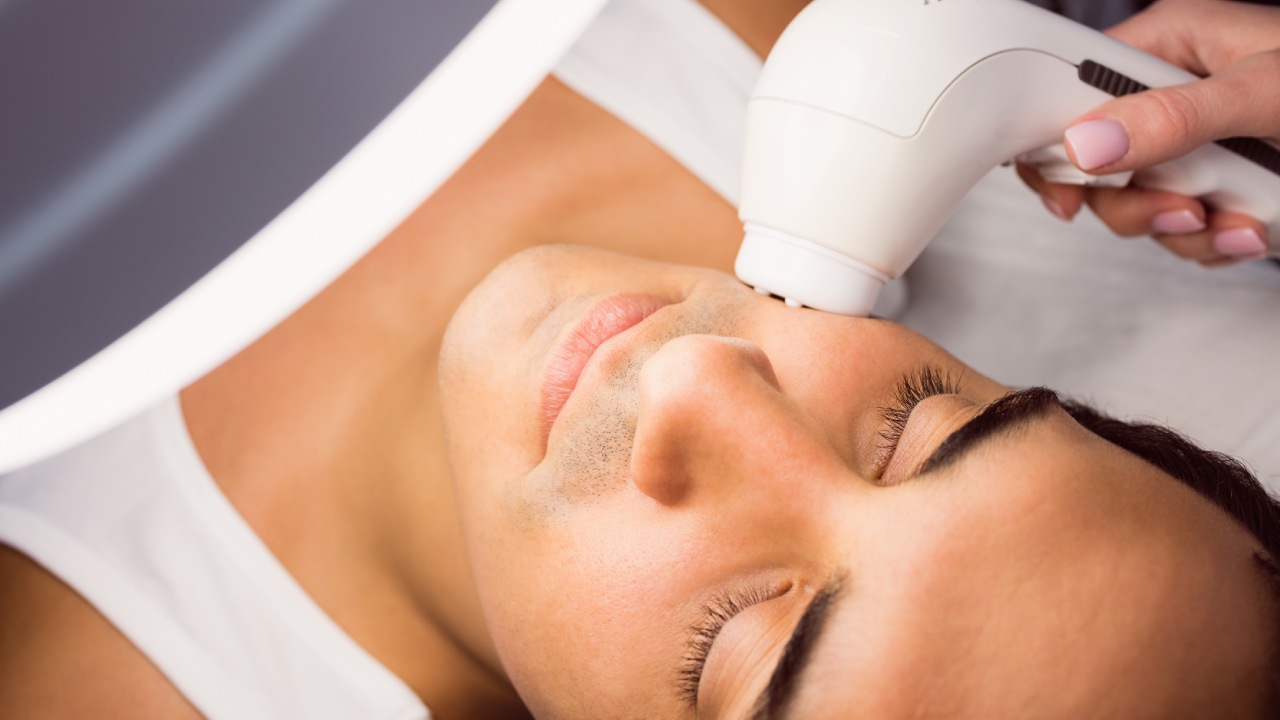 Épilation lumière pulsée visage : guide complet